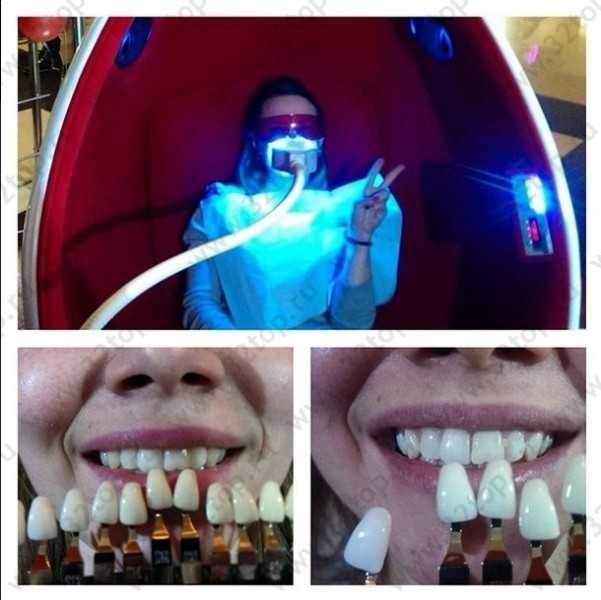 Салон косметического осветления зубов PEARLSMILE